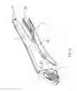 Fig. 07 - UNIVERSAL PLIER STRUCTURE