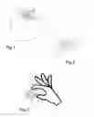 Fig. 02 - Tamperproof closure for use on a container, container therewith, and port for arrangement on the container