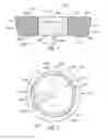 Fig. 02 - Food capsule with multiple compartments