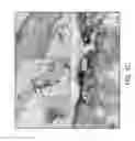 Fig. 09 - Detecting and Treating Liver Damage