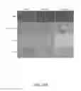 Fig. 43 - Detecting and Treating Liver Damage