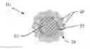 Fig. 01 - Hybrid rope