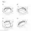 Fig. 04 - Ring light module