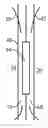 Fig. 01 - Single Evaporator Refrigeration System For Multi-Compartment Refrigerator Appliance With Isolated Air Flows