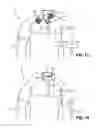 Fig. 10 - Integrated body armor garment