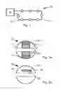 Fig. 02 - SYSTEM FOR MEASUREMENT WITH PEARLS
