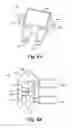 Fig. 08 - Package for a differential pressure sensing die