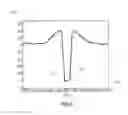 Fig. 07 - Method and device for estimating a profile depth of a tire