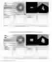 Fig. 08 - Systems, methods, and apparatuses for optical systems in flow cytometers