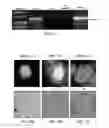 Fig. 02 - Composition and method for diagnosis and immunotherapy of prostate cancer