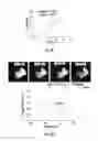 Fig. 07 - Non-invasive temperature mapping using temperature-responsive water saturation shift referencing (T-WASSR) MRI