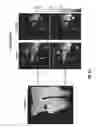 Fig. 08 - Non-invasive temperature mapping using temperature-responsive water saturation shift referencing (T-WASSR) MRI