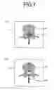 Fig. 08 - Image processing device and spinal canal evaluation method