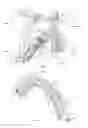 Fig. 03 - APPARATUS TO EMIT THERAPEUTIC RADIATIONS