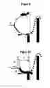 Fig. 09 - DEVICE FOR FISHING