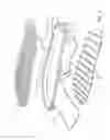 Fig. 02 - Footwear Sole Structure with Suspended Elastomeric Web or Mesh Support