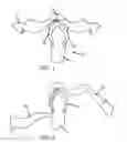 Fig. 02 - METHOD AND KIT FOR ACCESSORIZING A SANDAL