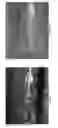 Fig. 15 - Analyte sensors comprising hydrogel membranes