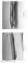 Fig. 28 - Analyte sensors comprising hydrogel membranes