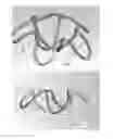 Fig. 02 - CONSTRICTOR FOR CLOSING OR NARROWING A PASSAGE THROUGH TISSUE OF A HOLLOW ORGAN