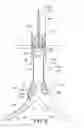 Fig. 07 - INFLATABLE OCCLUSION WIRE-BALLOON FOR AORTIC APPLICATIONS