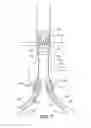 Fig. 08 - INFLATABLE OCCLUSION WIRE-BALLOON FOR AORTIC APPLICATIONS