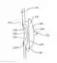 Fig. 01 - Atrial appendage closure device and related methods