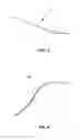 Fig. 06 - Single incision laparoscopic tissue retrieval system