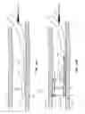 Fig. 09 - EMBOLIC FILTER BALLOON