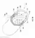 Fig. 09 - Fracture fixation systems having intramedullary support
