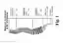 Fig. 02 - Wave Spring for a Spinal Implant