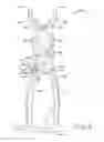 Fig. 08 - Prosthetic inserter