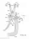 Fig. 12 - Prosthetic inserter