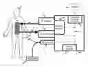 Fig. 01 - Method to detect changes in a patient's endogenous temperature set-point during externally induced targeted temperature management
