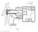 Fig. 02 - Method to detect changes in a patient's endogenous temperature set-point during externally induced targeted temperature management