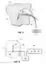 Fig. 06 - PORTABLE, ADJUSTABLE DISPOSABLE MEDICAL SUCTION SYSTEM AND METHOD OF USE