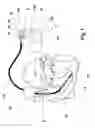 Fig. 02 - Implantable device
