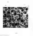 Fig. 04 - Insert molding of bulk amorphous alloy into open cell foam