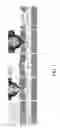 Fig. 02 - PATCHING ROAD BEDS