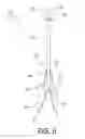 Fig. 05 - Ground anchor