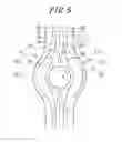 Fig. 06 - Metal gasket