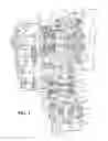 Fig. 02 - Flow-restricting plug and differential drive pinion having the same