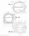 Fig. 04 - Flow-restricting plug and differential drive pinion having the same
