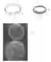 Fig. 02 - Illumination arrangement for a timepiece
