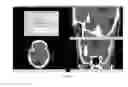 Fig. 09 - Method and system for simulating surgical procedures
