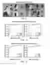 Fig. 07 - Template-less method for arbitrary radiopaque object tracking in dynamic imaging