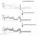 Fig. 01 - Methods and devices for displaying trend and variability in a physiological dataset