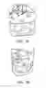 Fig. 08 - Fast Superconducting Switch for Superconducting Power Devices