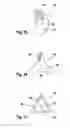 Fig. 07 - Head for an oral care implement