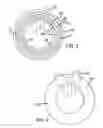 Fig. 03 - Decorative Wreath Device